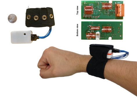 diagram of the bioimpedance bracelet and its electronics